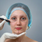 Non-Surgical Facelifts